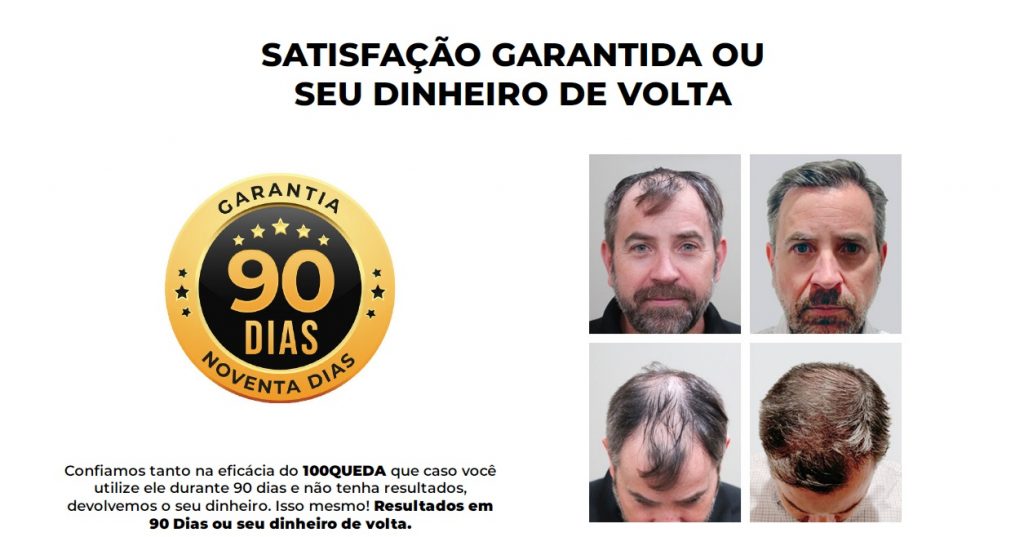 100queda-tratamento